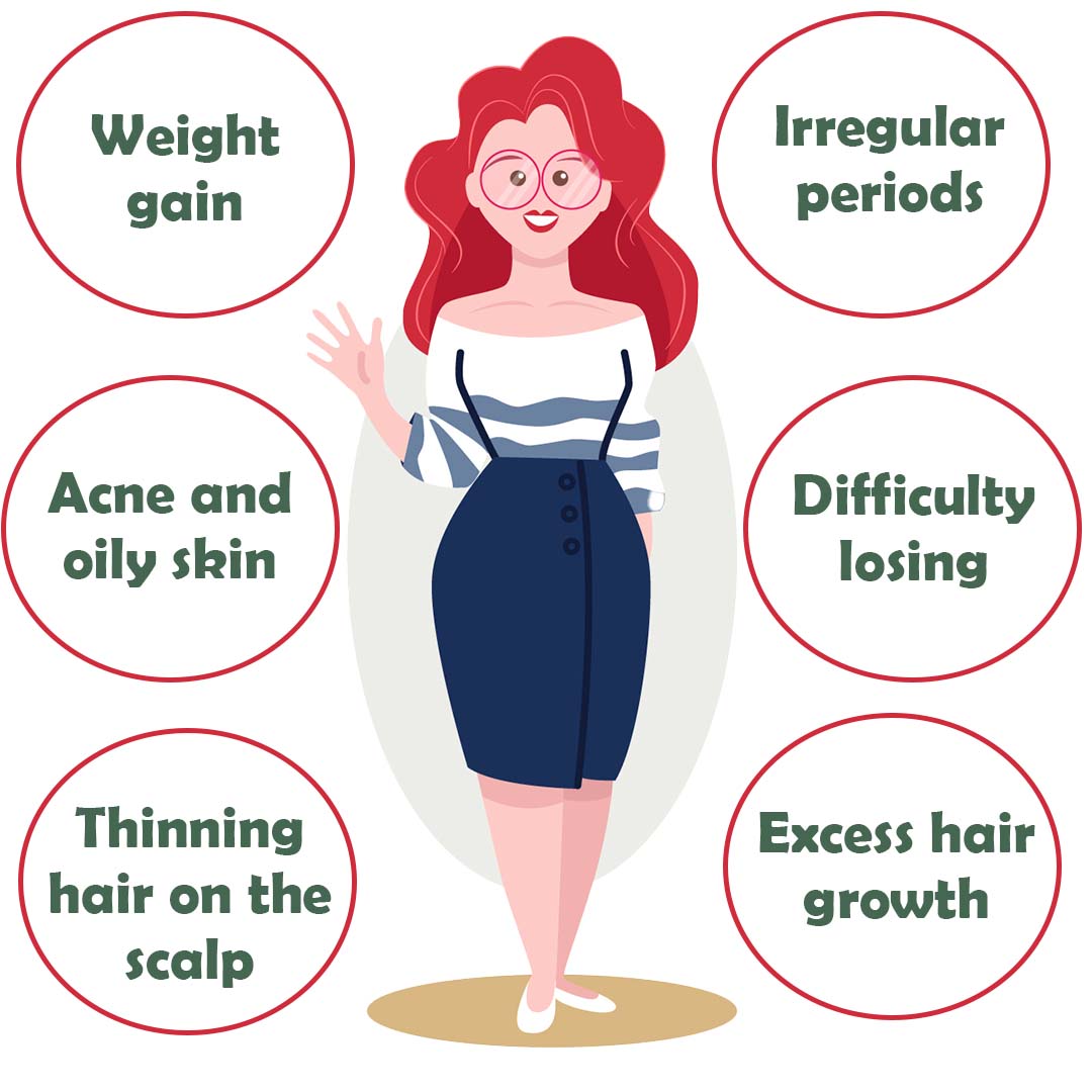 Common symptoms of PCOS illustrated